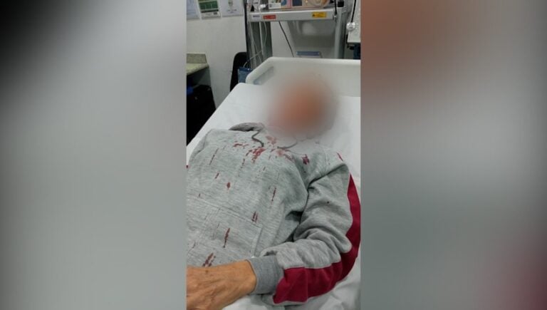 Mulher é atingida por madeira que caiu de obra irregular em Piracicaba