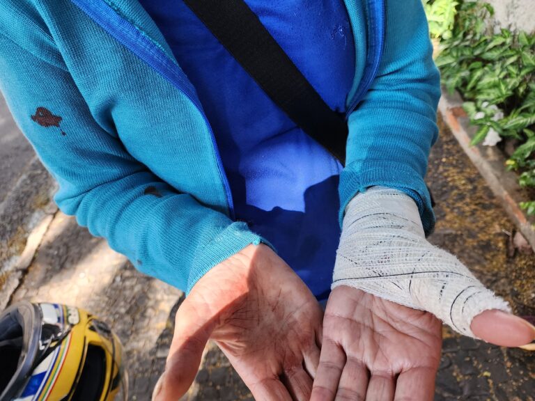 Pitbull mata cadelinha e fere idosa em Limeira; tutor é preso por dívida de pensão