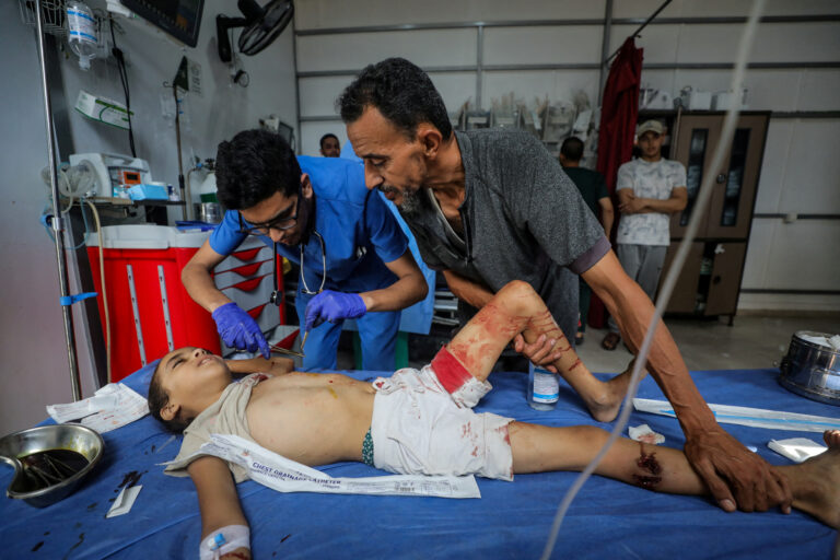 Uma criança palestina, ferida em um ataque israelense que matou pessoas que se reuniram para coletar água em um ponto de distribuição, recebe tratamento no Hospital Al-Awda em Nuseirat, no centro da Faixa de Gaza | REUTERS/Stringer