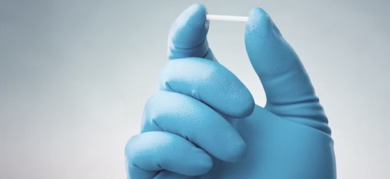 Implanon será oferecido gratuitamente pelo SUS; saiba como vai funcionar