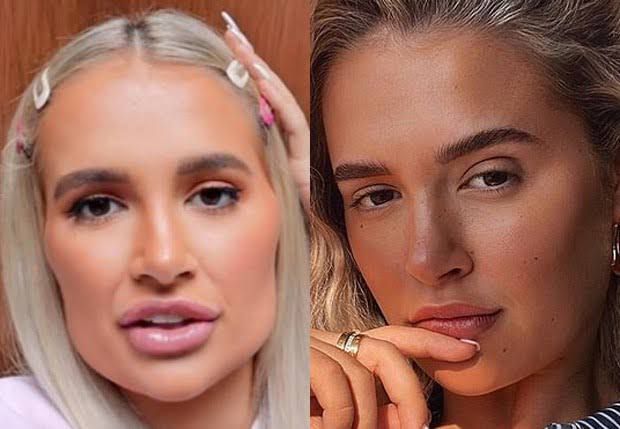 Naturalidade é a nova tendência na harmonização facial