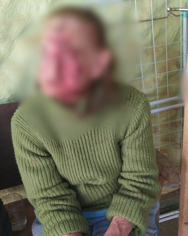 Idosa é agredida com chave de fenda em Campos do Jordão