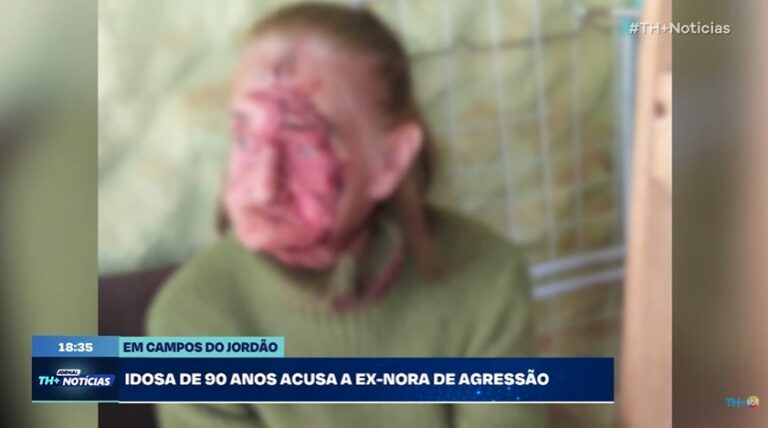 Idosa de 90 anos acusa ex-nora de agressão com chave de fenda em Campos do Jordão