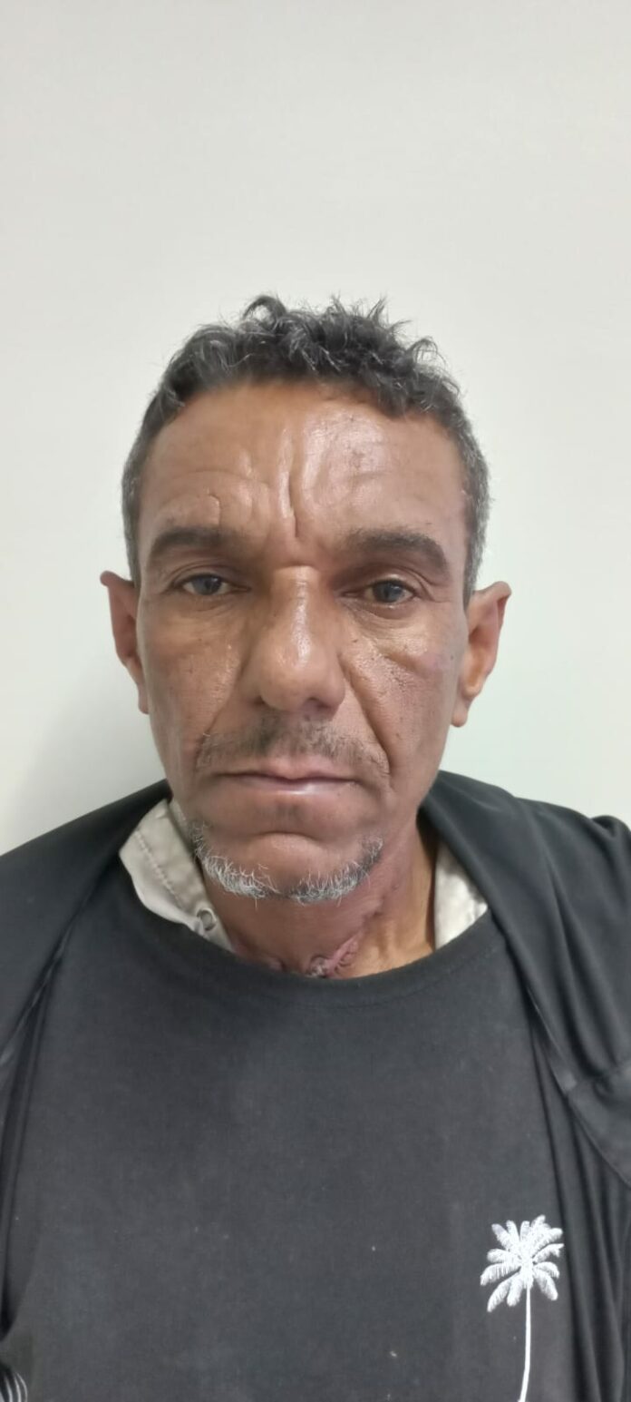 Suspeito de agredir ex com tesoura é preso em São José