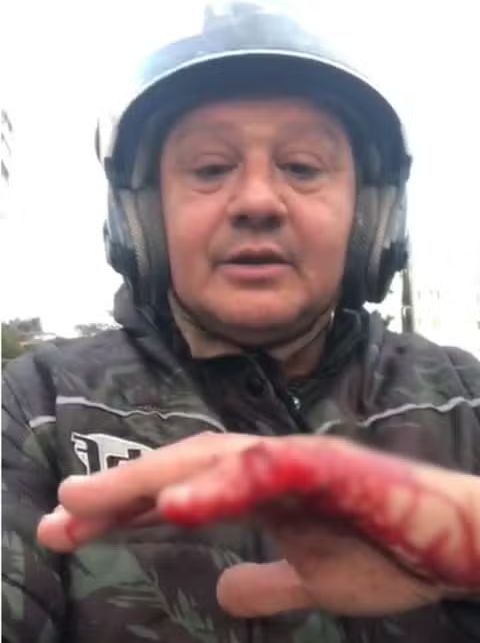 Motociclista escapa de linha de pipa com cerol, corta dedo e faz alerta em São Vicente; VÍDEO