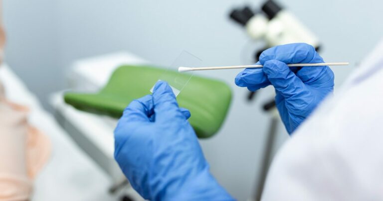 Exame inovador para câncer de colo de útero começa a ser adotado em Ribeirão Preto