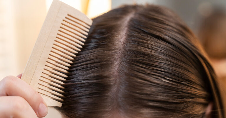 USP de Ribeirão Preto precisa de voluntárias para estudo clínico sobre o couro cabeludo