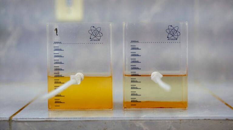A pesquisa é da Universidade Federal do Rio Grande do Norte (UFRN) e tem 96% de eficiência