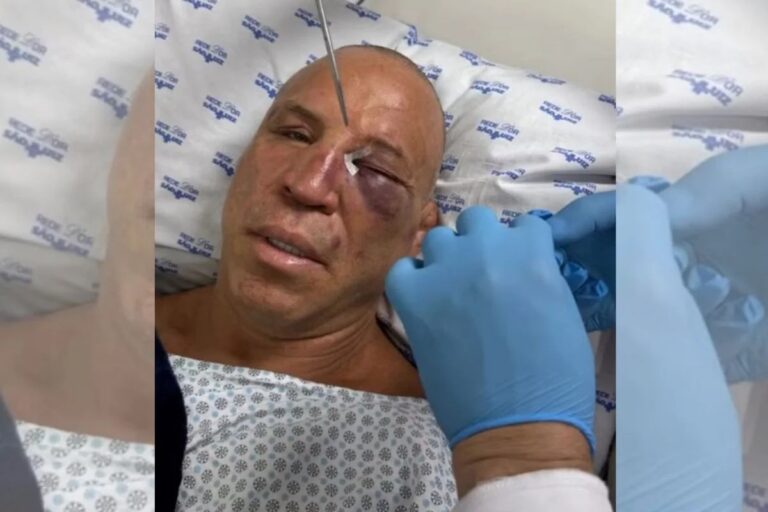 ‘Dor de cabeça que não passa’, diz Wanderlei Silva após nocaute em briga