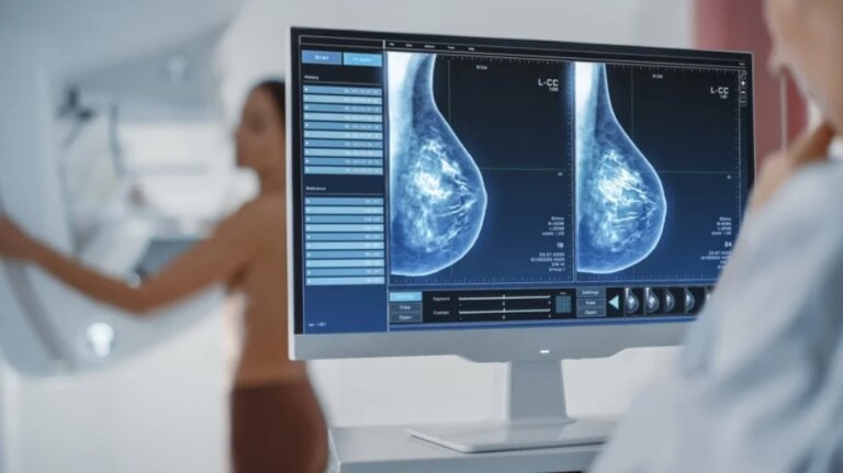 Ministério da Saúde anuncia acesso a mamografia a partir dos 40 anos