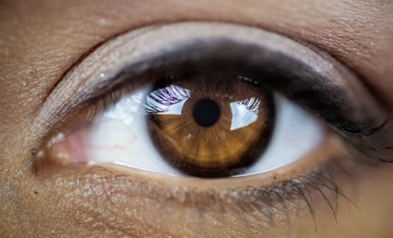 Mudar a cor dos olhos: vaidade em alta, risco à visão em alerta