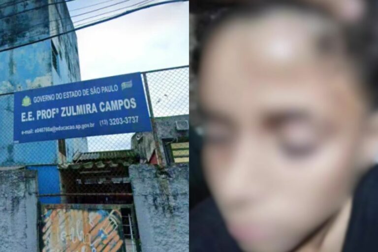 Menino de 12 anos com síndrome de Tourette é espancado até ficar desacordado em escola no litoral