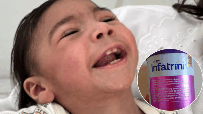 Crianças com necessidades especiais ficam sem leite medicinal em Sumaré