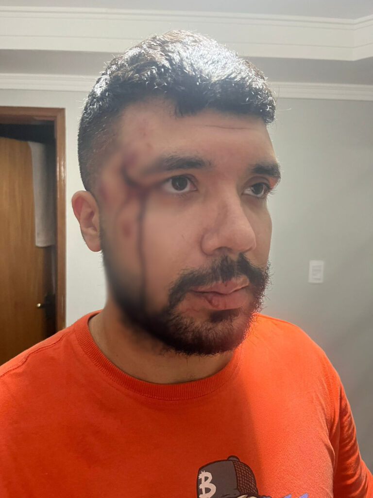 Motorista de app é agredido com mata-leão e socos por passageiro em Campinas