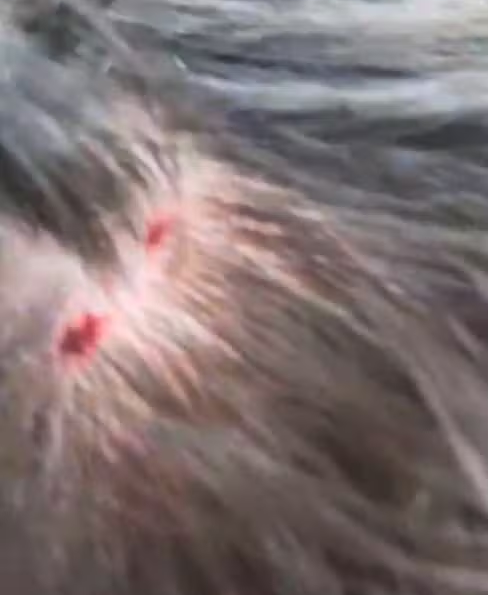 Estudante fica com a cabeça ferido após ser atacado por gavião em Santos