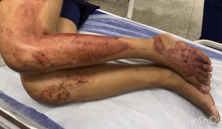 Falta de punição severa e a cultura do silêncio: O que está por trás do aumento do feminicídio em Ribeirão Preto?