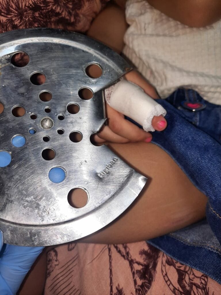 Criança de 3 anos fica com dedo preso no ralo e é levada ao hospital em Ubatuba