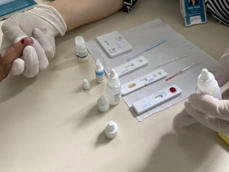 Araçatuba vai intensificar testagem de HIV e sífilis em todas as UBSs