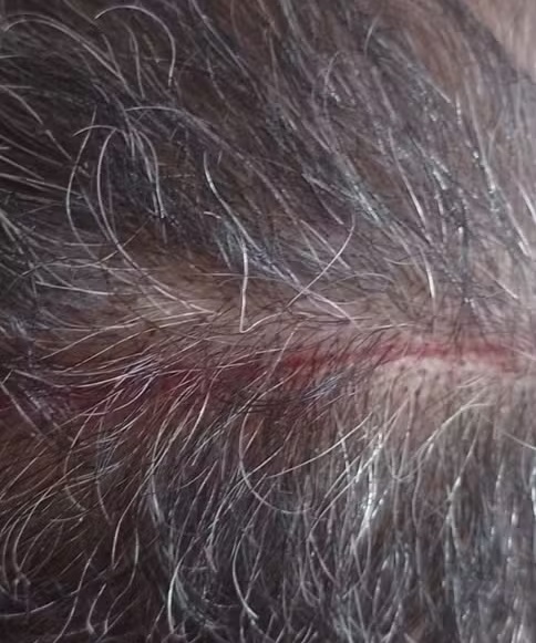 Homem é atacado por gavião enquanto ia para a igreja em Santos