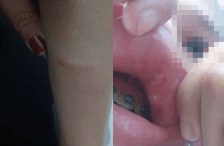 Criança é agredida por colegas em escola; mãe acusa unidade de omissão