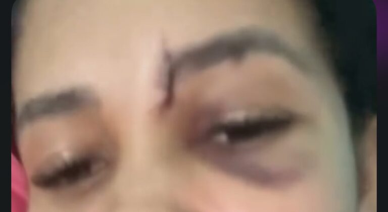 Após levar soco e puxão de cabelo, jovem denuncia homem à polícia