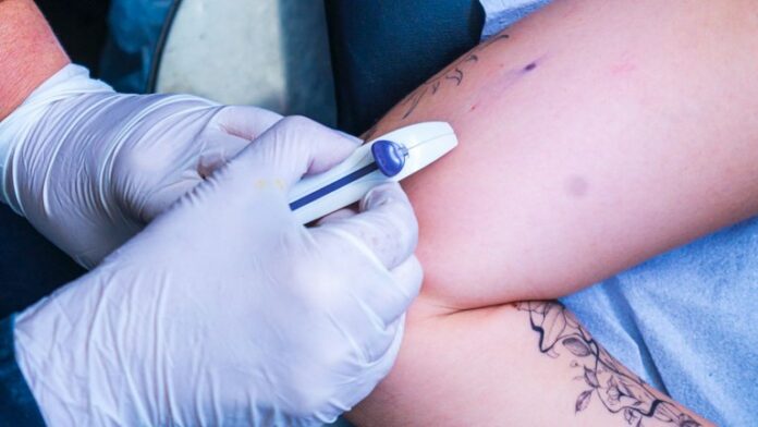 Treinamento prático ocorreu em Bayeux e prepara profissionais de 11 municípios para iniciar o serviço na rede pública