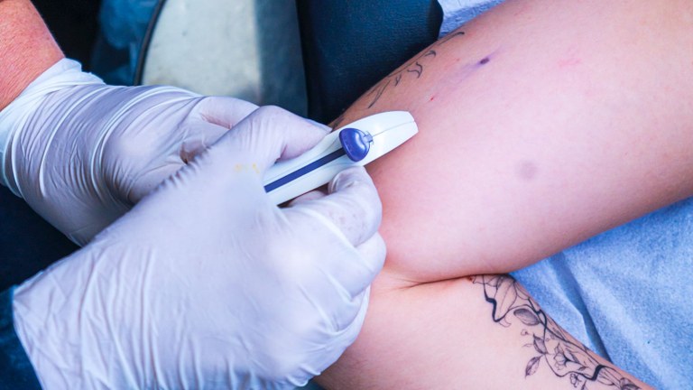 Treinamento prático ocorreu em Bayeux e prepara profissionais de 11 municípios para iniciar o serviço na rede pública