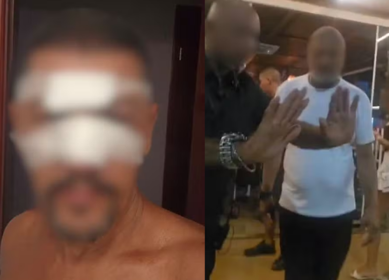 Homem é agredido por segurança de quiosque em Praia Grande após amigo perder a comanda