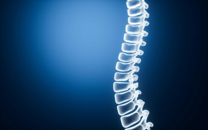 Disco artificial na coluna mantém movimento e acelera recuperação, diz especialista