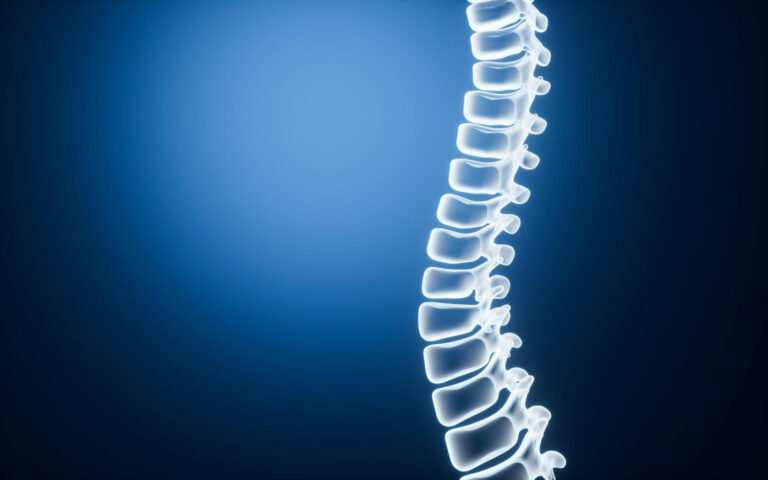 Disco artificial na coluna mantém movimento e acelera recuperação, diz especialista