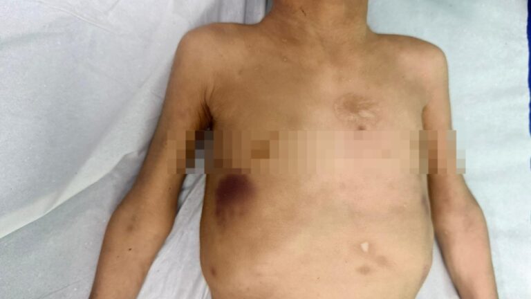 Namorada confessa agressões frequentes e casal é preso preventivamente por suspeita de tortura