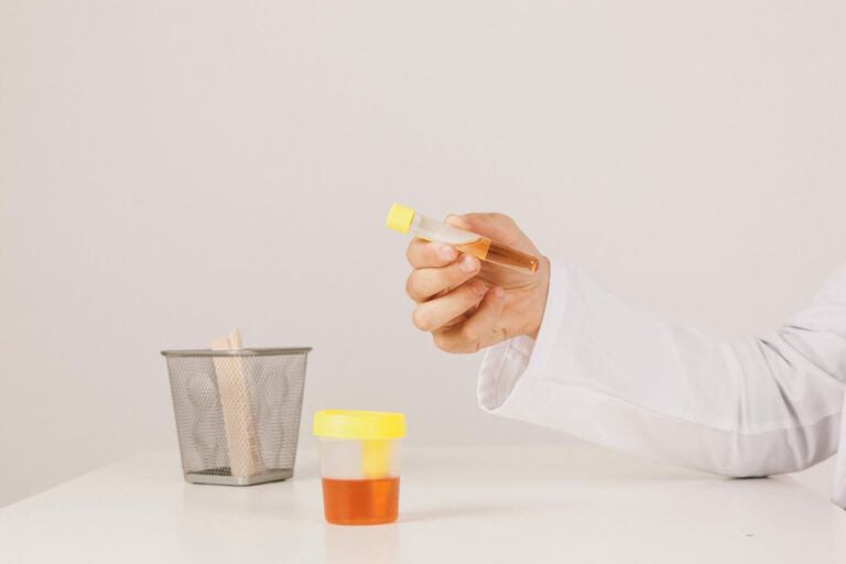 Xixi escuro depois do treino pode ser alerta: quando o corpo pede socorro