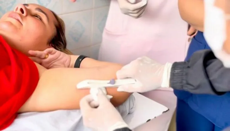 Implanon passa a ser oferecido gratuitamente em unidades de saúde de João Pessoa