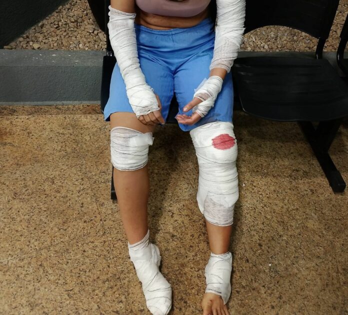 Mulher pula de carro em movimento para escapar de agressões do companheiro