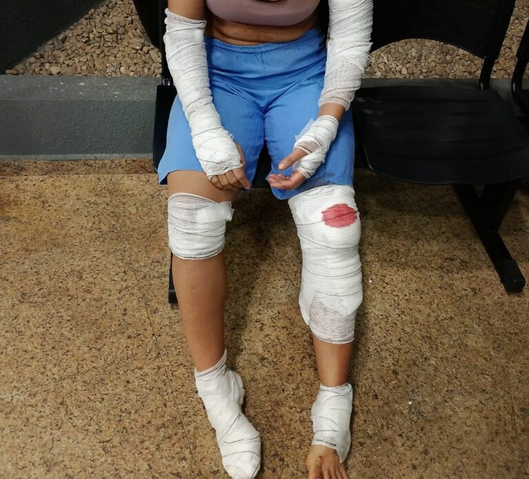 Mulher pula de carro em movimento para escapar de agressões do companheiro