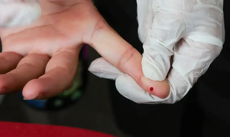 SUS passa a oferecer teste rápido para detecção precoce da dengue