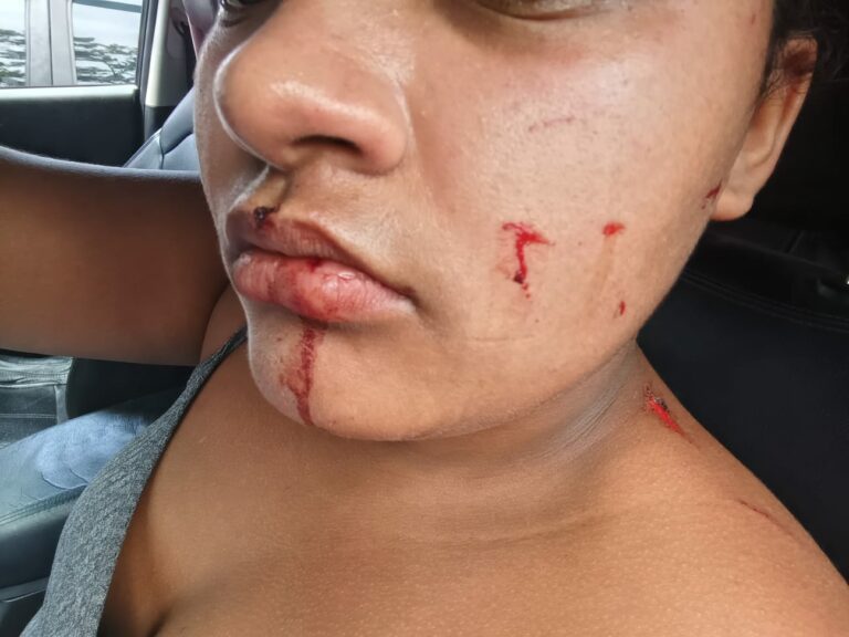 Estudante é agredida com chutes e puxões de cabelo dentro de escola estadual em Mongaguá