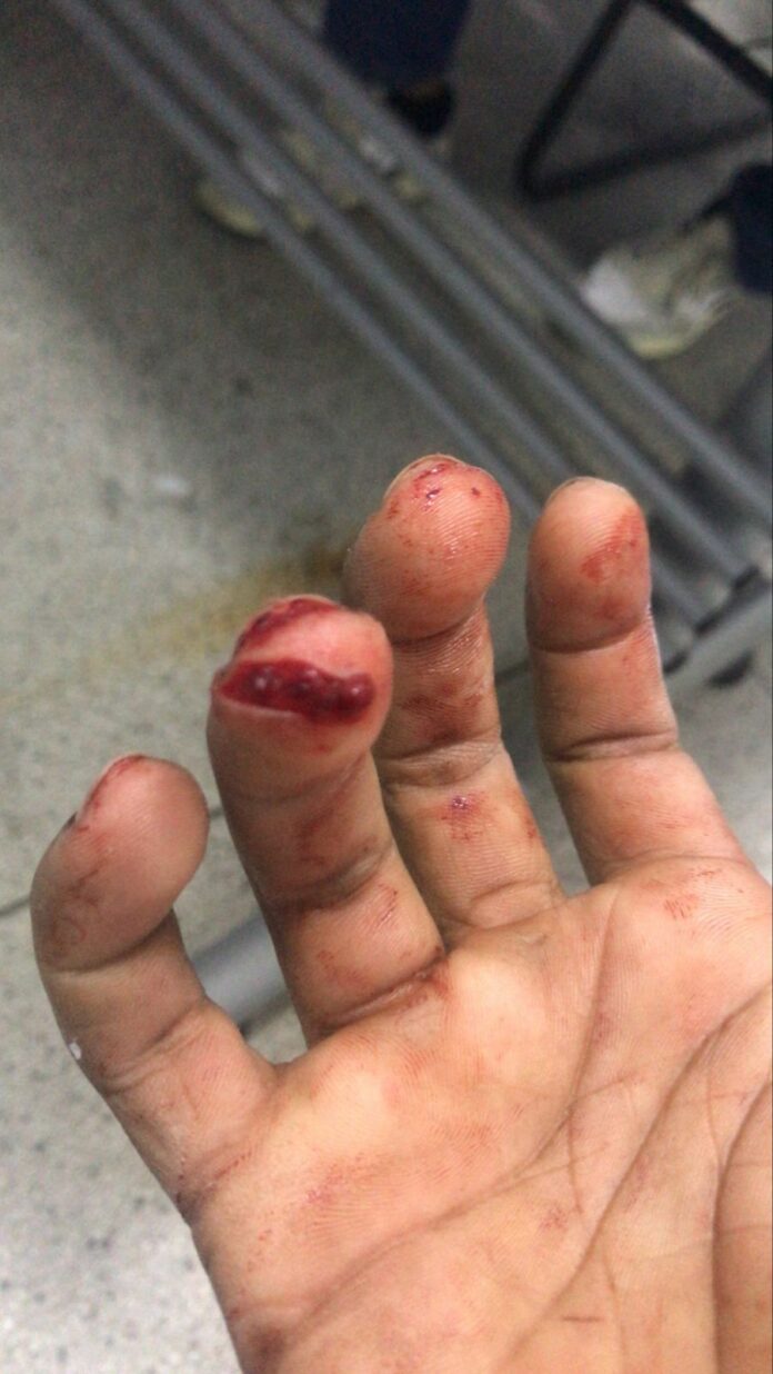 Pai é preso após tentar matar filhos com facão em Caçapava