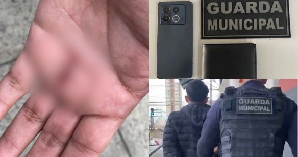 Enfermeiro é atacado com pedaço de madeira ao sair do trabalho em Campinas