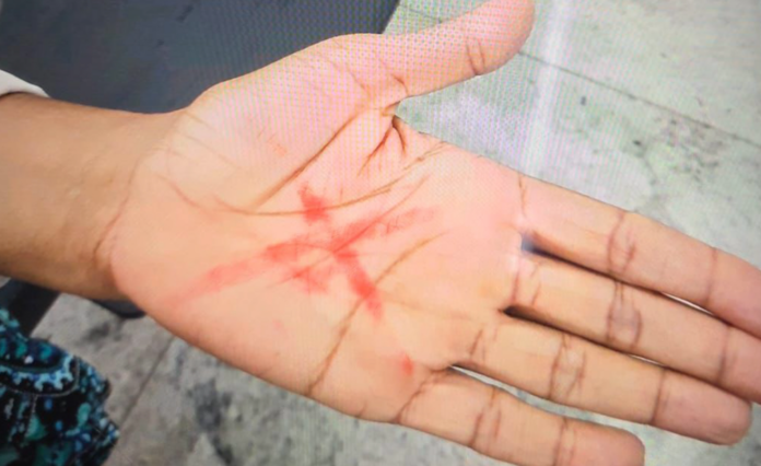 Mulher desenha X com batom na mão e funcionária de loja entende pedido de socorro