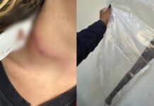 Mulher é esfaqueada no pescoço pelo namorado em Piracicaba