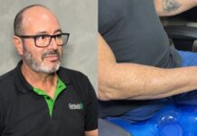 Após quase um ano, motociclista que perdeu a perna em acidente fala pela primeira vez