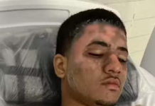 Homem descumpre medida protetiva, invade casa da ex e é queimado com água fervendo