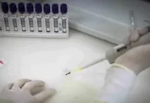 Suspeita de Ebola mobiliza autoridades de saúde em São Paulo