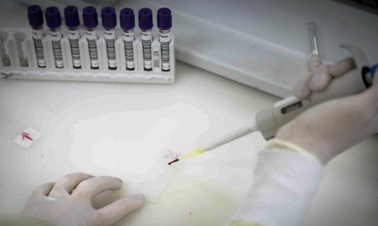 Suspeita de Ebola mobiliza autoridades de saúde em São Paulo
