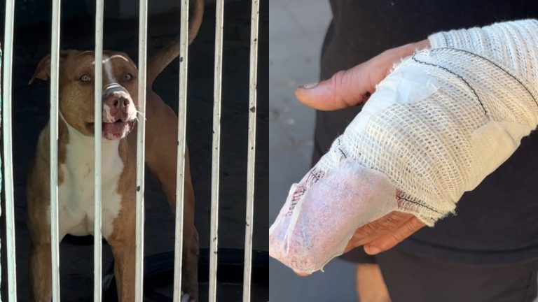 Pitbull escapa e ataca vizinho em Campinas
