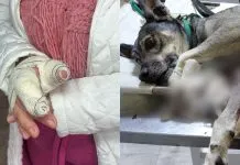 Pitbulls escapam e atacam idosa que passeava com o cachorro