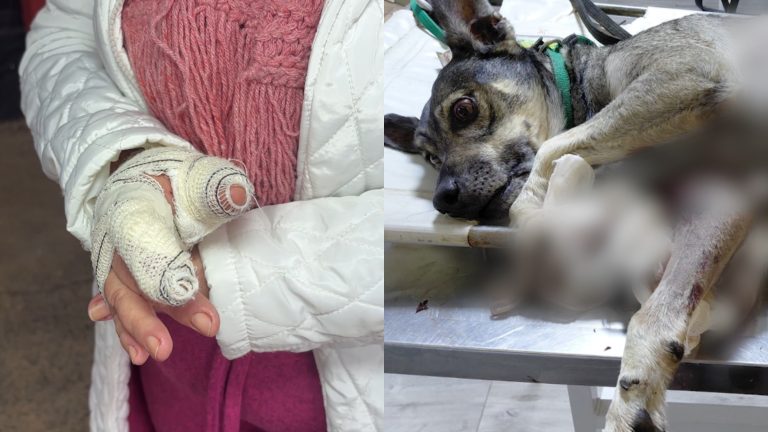 Pitbulls escapam e atacam idosa que passeava com o cachorro