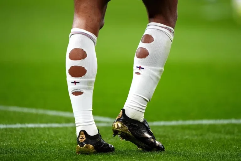 Por que jogadores rasgam os meiões? Especialista explica