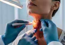 Nódulo na tireoide: técnica sem cortes pode evitar cirurgia em casos selecionados